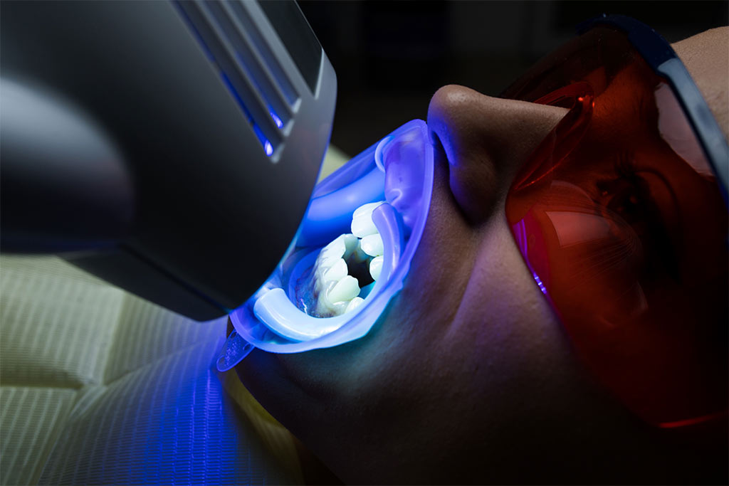 tratamiento para manchas en los dientes
