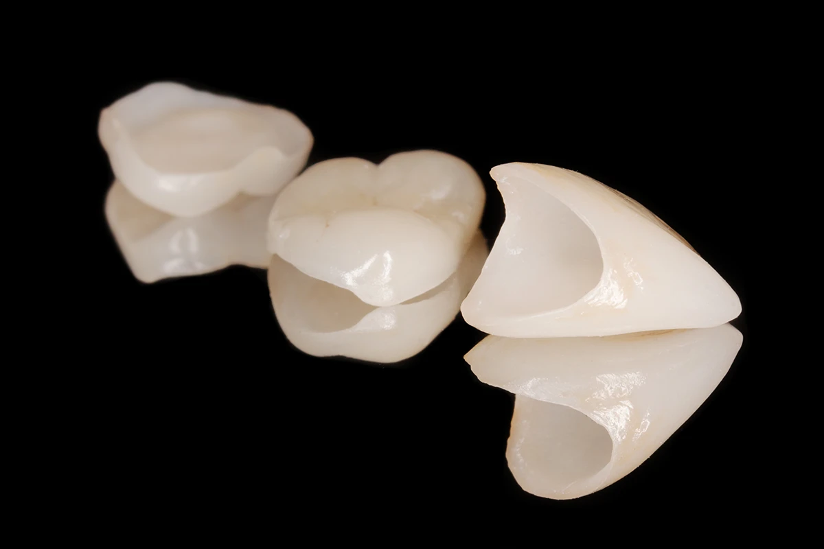 Beneficios de las coronas dentales