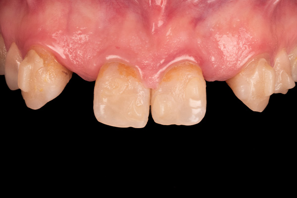 Caso clínico 1 antes