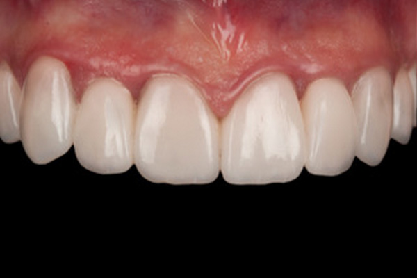 Caso clínico 1 después