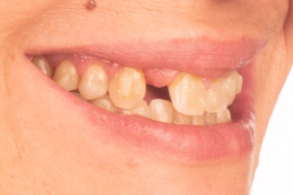 Caso clínico 1.2 antes