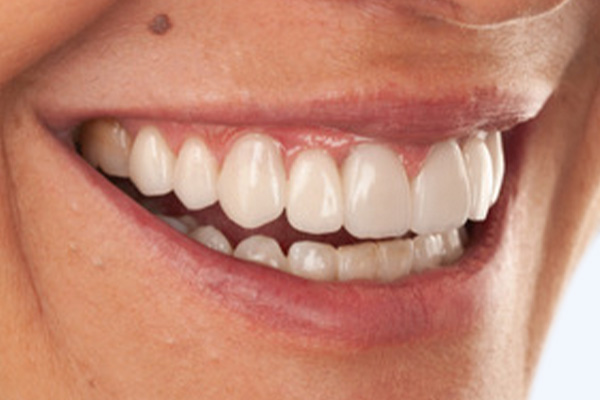 Caso clínico 1.2 después