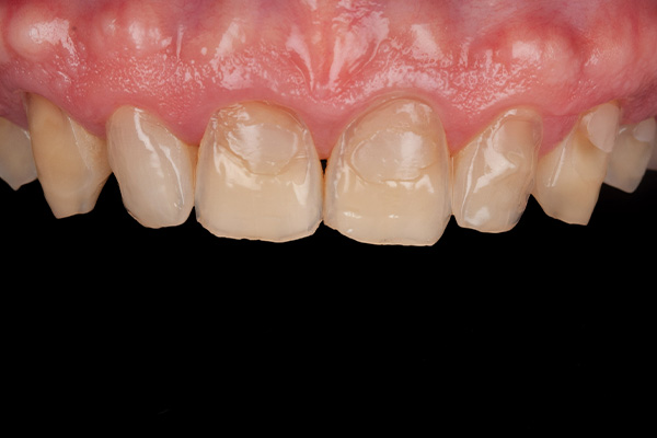 Caso clínico 2 antes