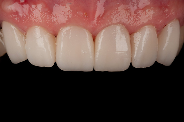 Caso clínico 2 después