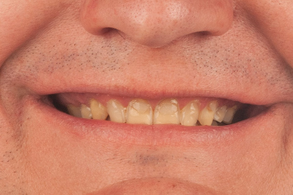 Caso clínico 2.1 antes