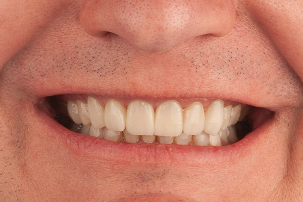 Caso clínico 2.1 después