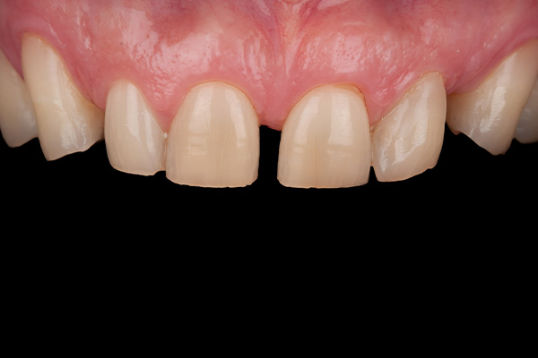 Caso clínico 3 antes