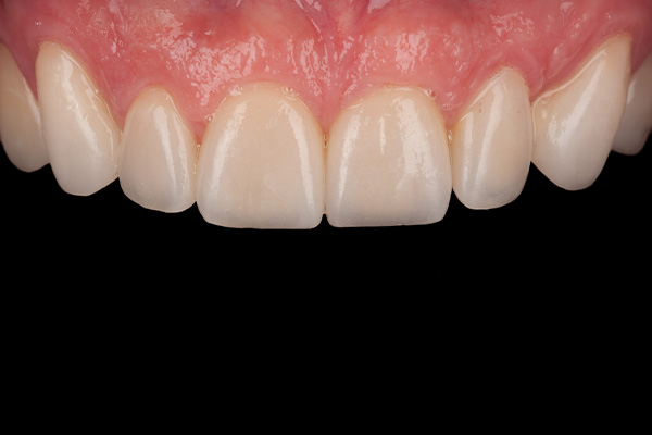 Caso clínico 3 después