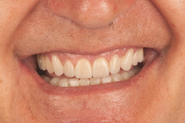 Caso clínico 3.1 después