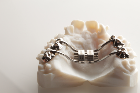disyuntor de paladar en molde dental